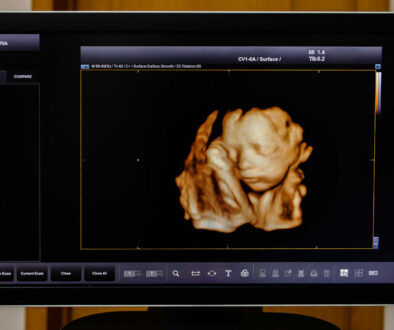A Picture of a Fetus Shows the Differences Between 3D and 4D Ultrasounds
